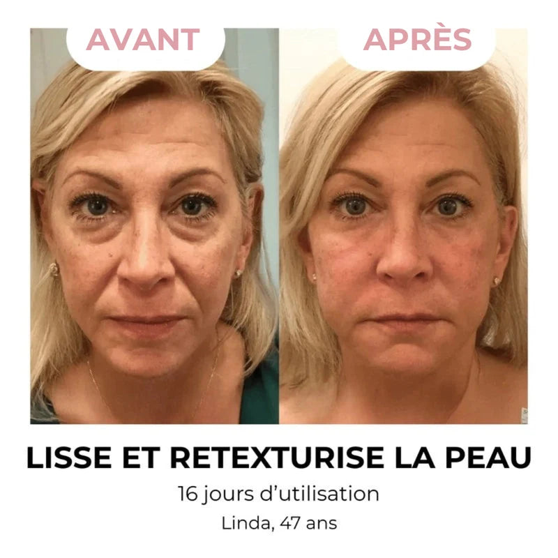 CoreStyle - Brosse Drainage Lymphatique Visage