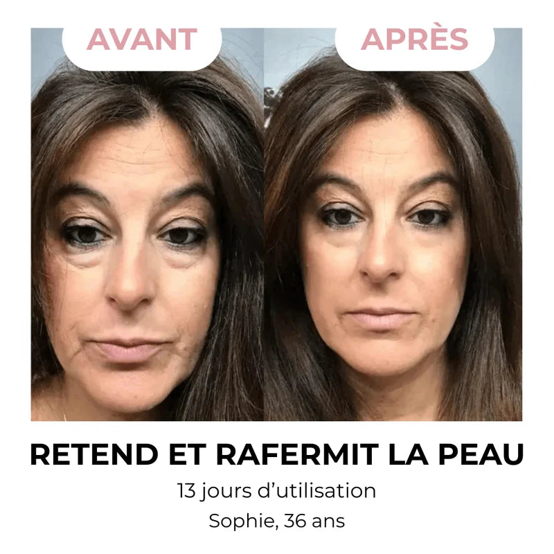 CoreStyle - Brosse Drainage Lymphatique Visage