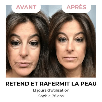 CoreStyle - Brosse Drainage Lymphatique Visage